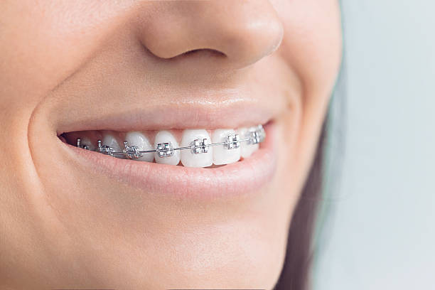 Dental Inlays and Onlays in Odenton, MD